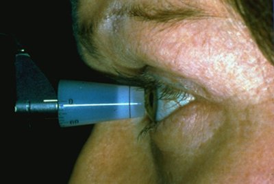 Prefeitura realiza mutirão para detecção de glaucoma