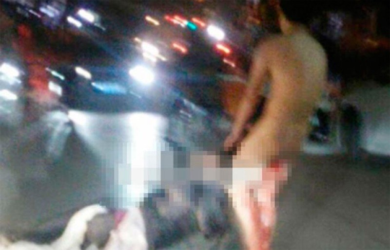 Mulher corta o pênis do marido duas vezes depois de traição