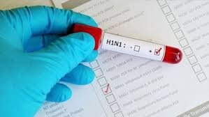 Não há registros de H1N1 em Vitória da Conquista