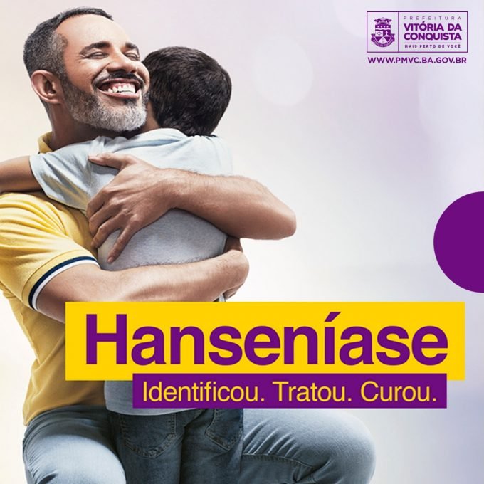 Secretaria de Saúde promove ações na campanha contra a Hanseniase