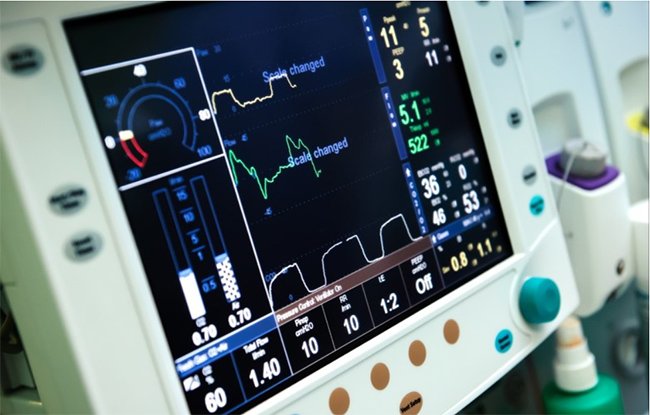 SENAI e indústrias brasileiras vão recuperar 3,6 mil respiradores mecânicos