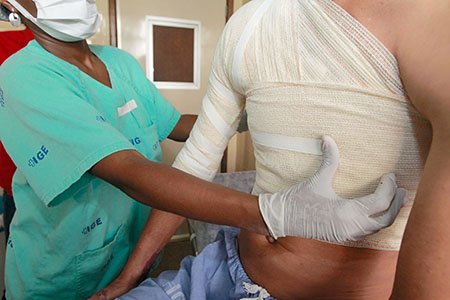 Bahia é referência no tratamento de queimados