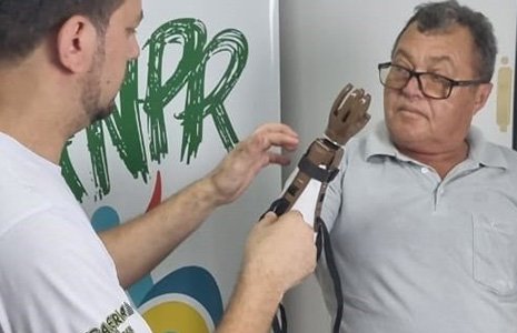 “Projeto Mão Solidária” do Rotary Club doa 100 próteses de mãos