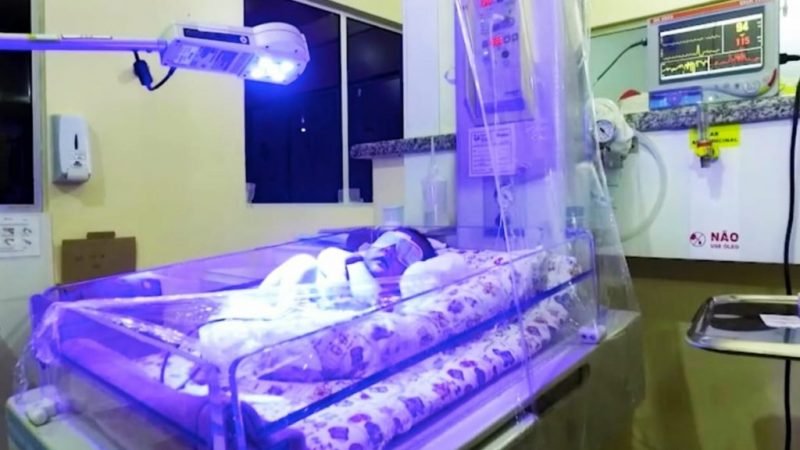 Bebês prematuros recebem atendimento qualificado e humanizado no Hospital Municipal Esaú Matos