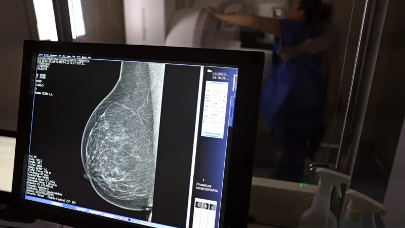 Sancionada lei que amplia acesso ao exame de mamografia fornecido pelo SUS