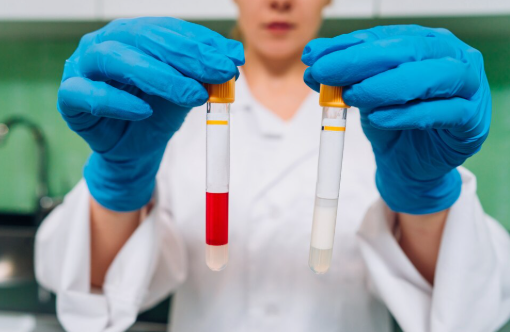 Principais doenças detectadas em exames de sangue, fezes e urina