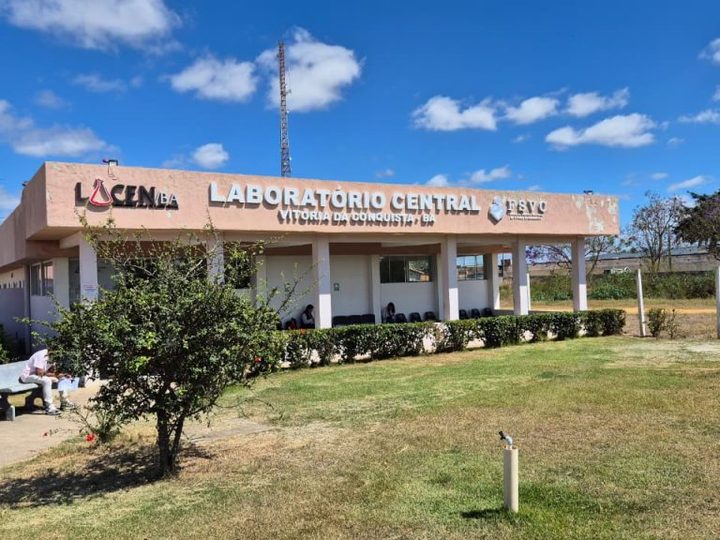 Lacem garante acesso à saúde e ao diagnóstico em Vitória da Conquista